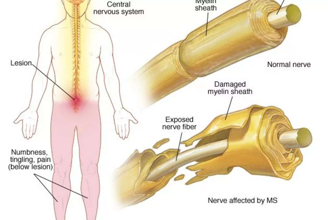Itching and nerve damage: understanding the connection